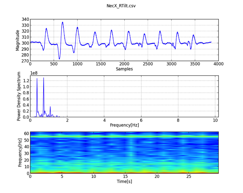 Figure1