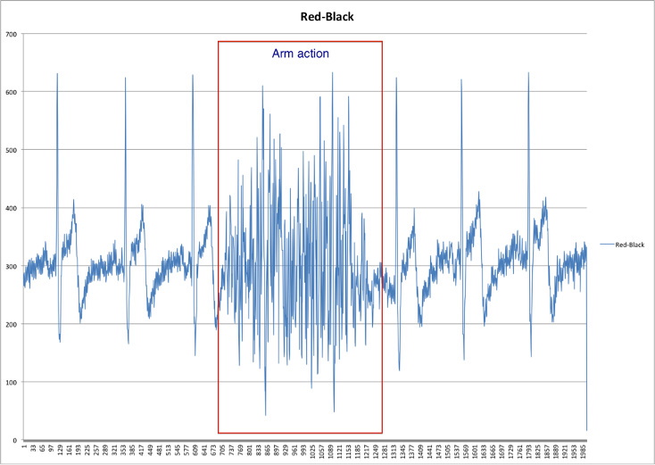 sEMG data